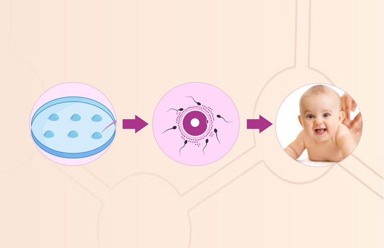 IVF Fertility Treatment